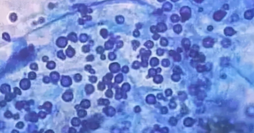 头屑头油彻底根治的洗发水,油头头皮屑多止痒洗发水测评