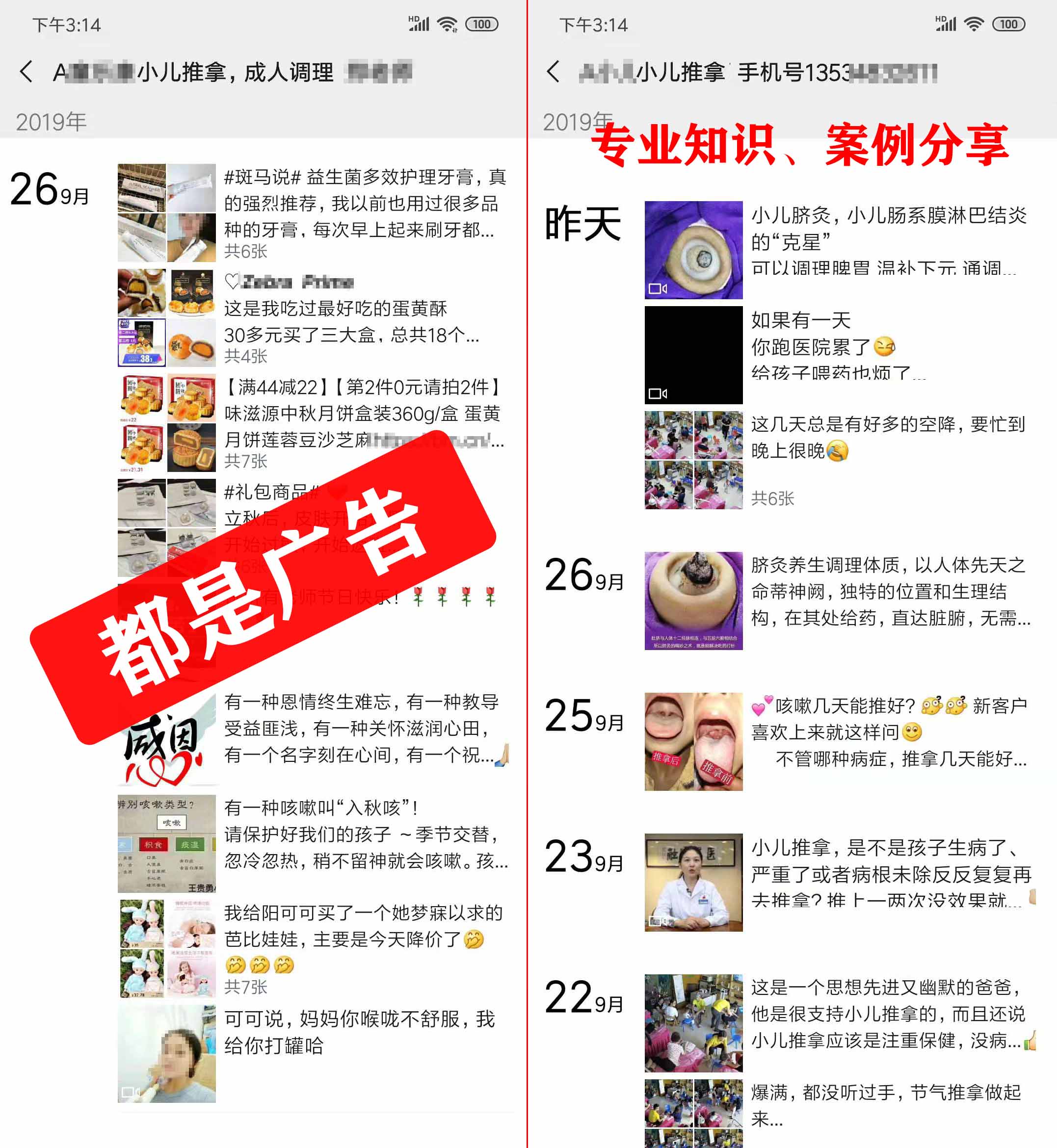 小儿推拿开业怎么搞活动吸引人,小儿推拿出去学习的宣传怎么发