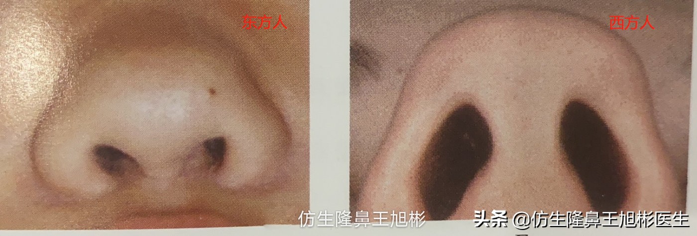 大鼻头能做直鼻微翘吗,可以只做鼻头缩小术吗