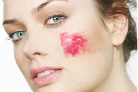 混油敏感肌最佳护肤方法,改善红血丝敏感肌的护肤产品