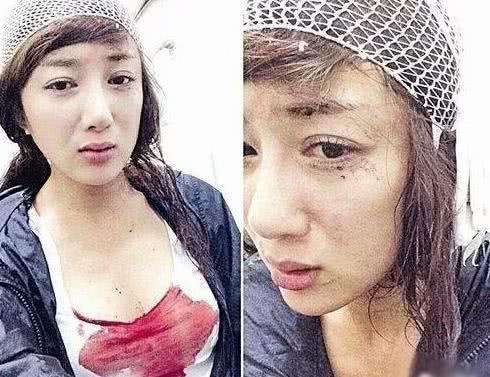 李依晓被狗咬赔偿了吗,李依晓被叶璇狗咬事件败诉