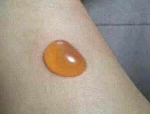 夏天艾灸手法视频,抓住大节气艾灸养生事半功倍