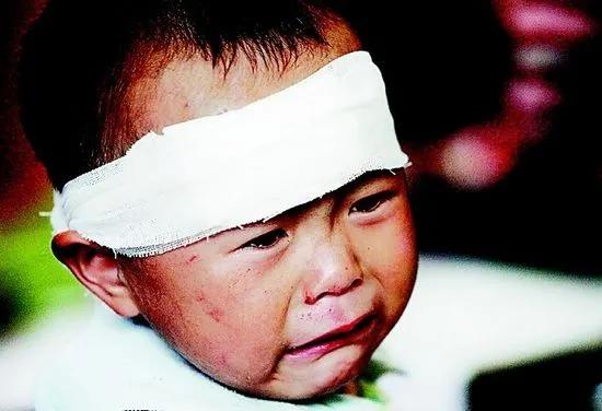 宝宝摔下沙发脑出血视频,1岁的宝宝摔到后脑涂什么药