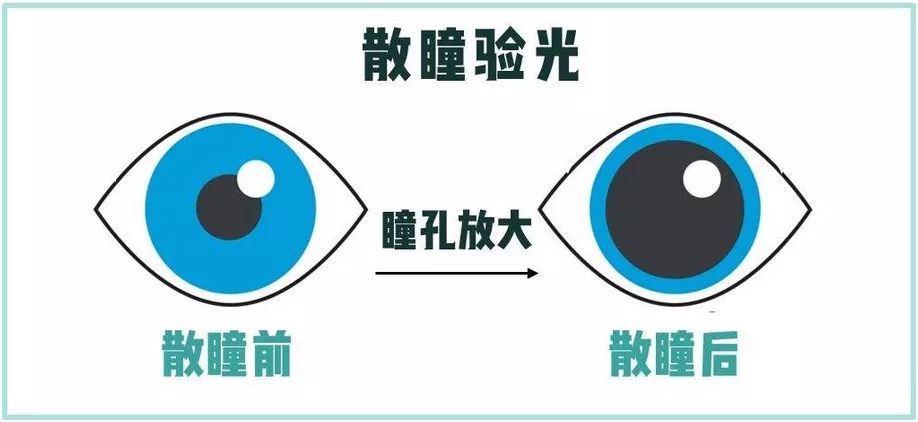 快散瞳慢散瞳的区别,什么是慢散瞳和快散瞳