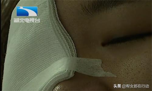 日本网红眼药水真相,日本网红眼药水