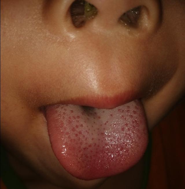 幼儿积食口臭怎么调理,幼儿积食口臭放屁臭吃什么药调理