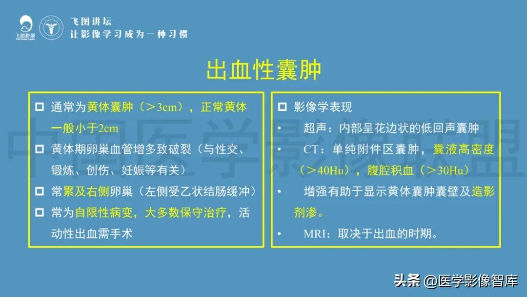 子宫解剖结构输卵管和卵巢位置,子宫附件ct影像学正常解剖表现