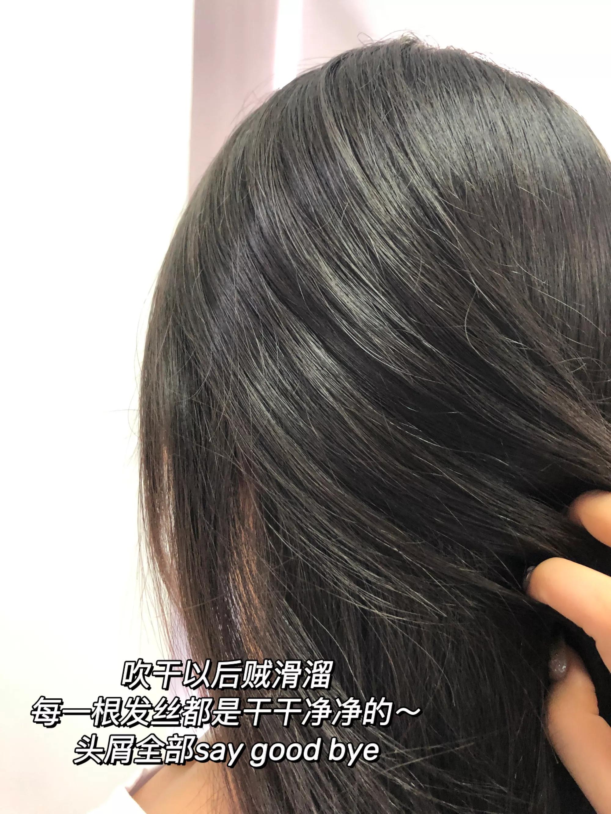 为什么从来没有头屑,你还在为头屑而烦恼吗