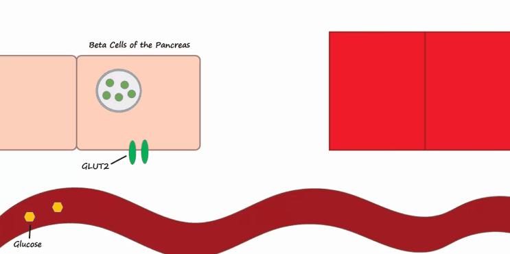 胰岛素是如何导致糖尿病的,胰岛素增多为什么会导致糖尿病