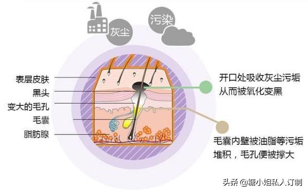 最简单最有效的去黑头的方法,如何正确去黑头简单有效