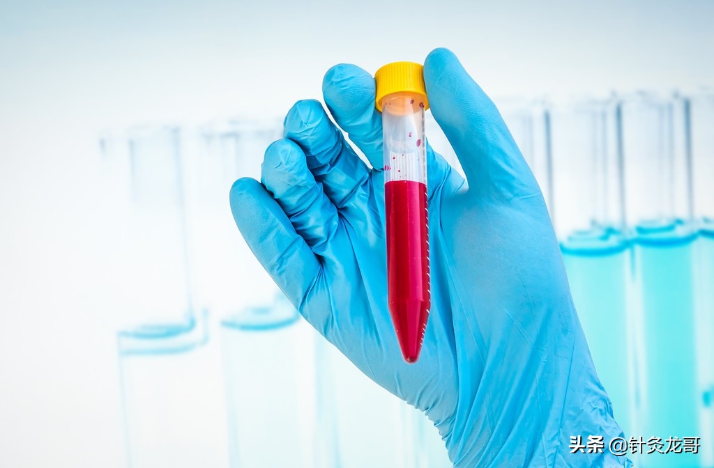 高密度胆固醇数值过高是什么原因,体检报告总胆固醇高怎么办