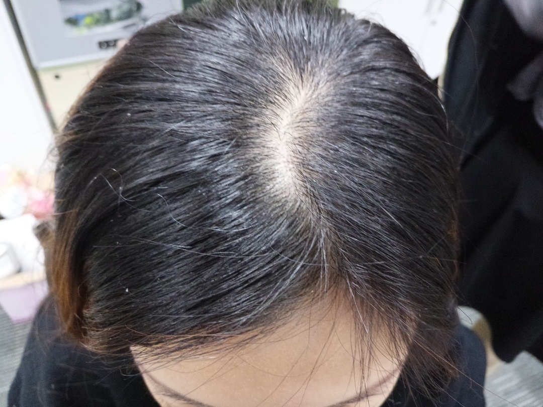 比较好用的德国防脱发,德国十大最好用的护肤品