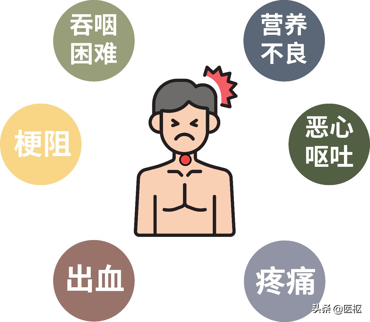 癌症食管癌,癌症食疗治疗方案