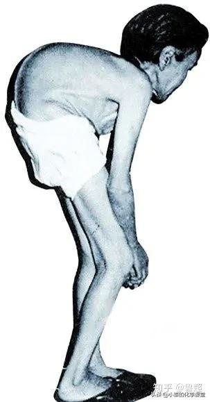 最致命的化学元素是什么,哪些化学物质会对身体有影响