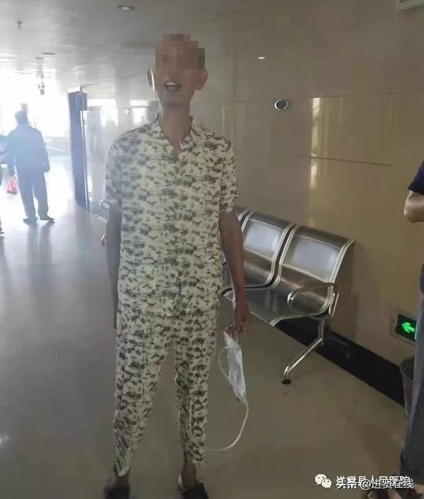 县医院成功进行腹腔镜手术,腹腔镜术后十天