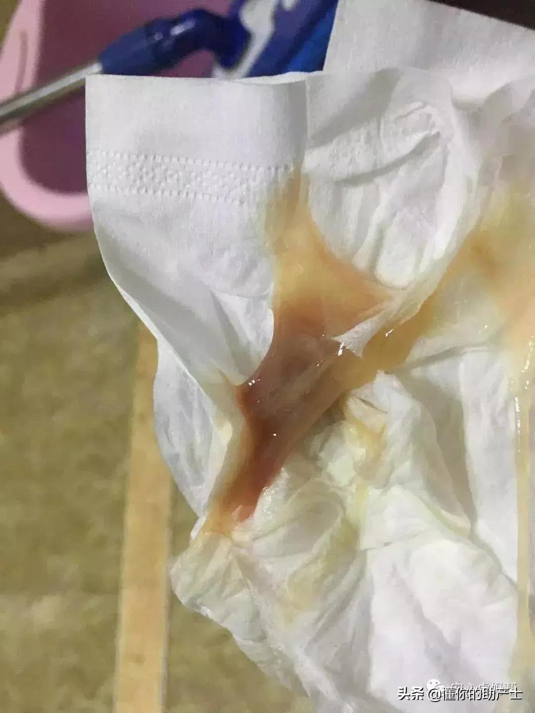 孕妇见红到最后的过程,怀孕见红是什么原理