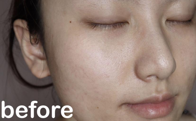 水润型粉底液混油皮,中三白适合什么粉底液雅诗兰黛