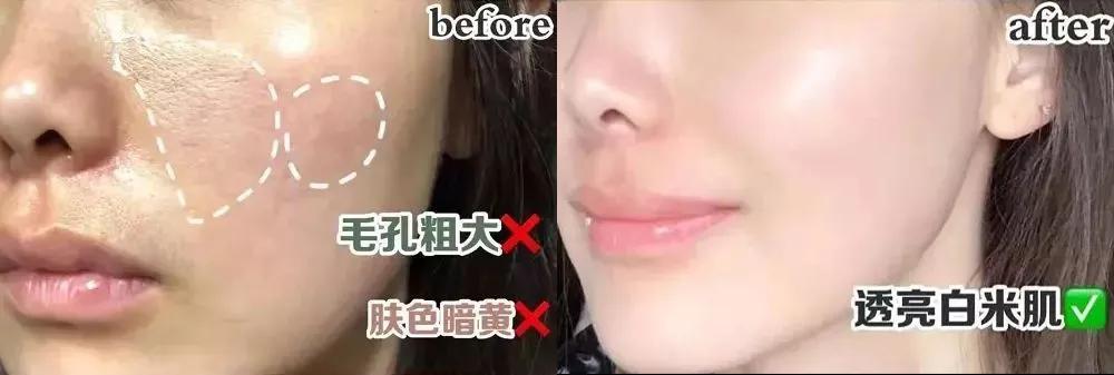 去角质慕斯可以去除死皮么,去角质慕斯去不去死皮