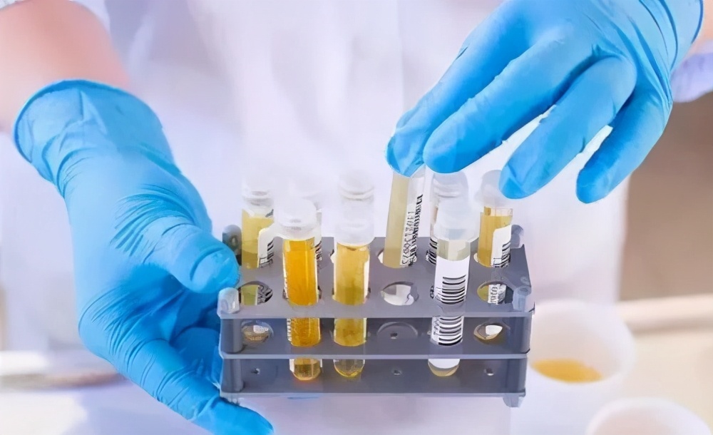 小便时痛是怎么回事如何治疗,小便时痛是什么原因