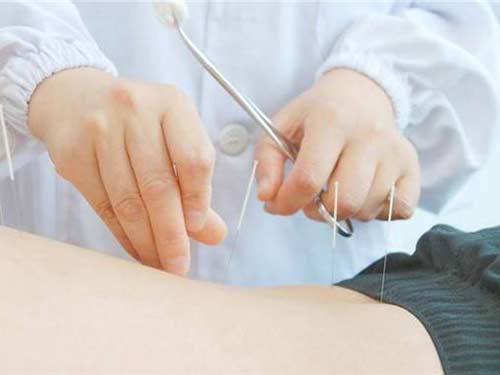 中医如何辨证肥胖,中医减肥怎样判断肥胖类型