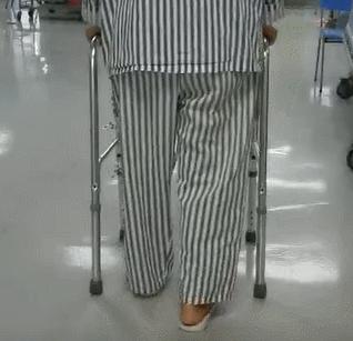 髋关节疼痛自愈的最佳方法,髋关节疼痛走路一瘸一拐