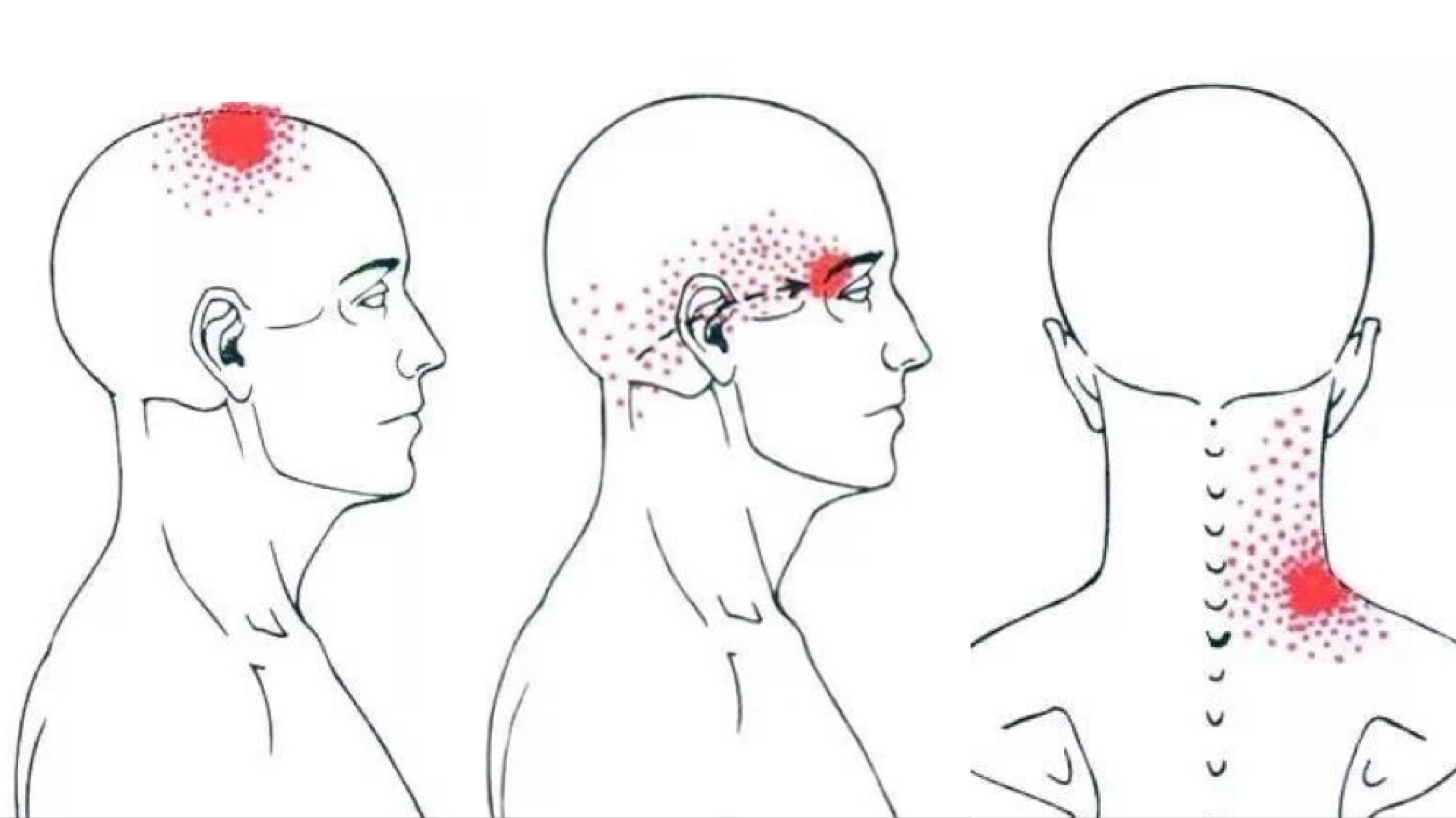 头晕脑胀后脖颈僵硬挂什么科,头晕脑胀颈后僵硬教你几招来缓解