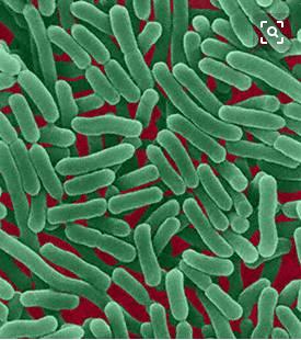 散装食品致病菌限量标准,食品微生物中的致病菌有哪些