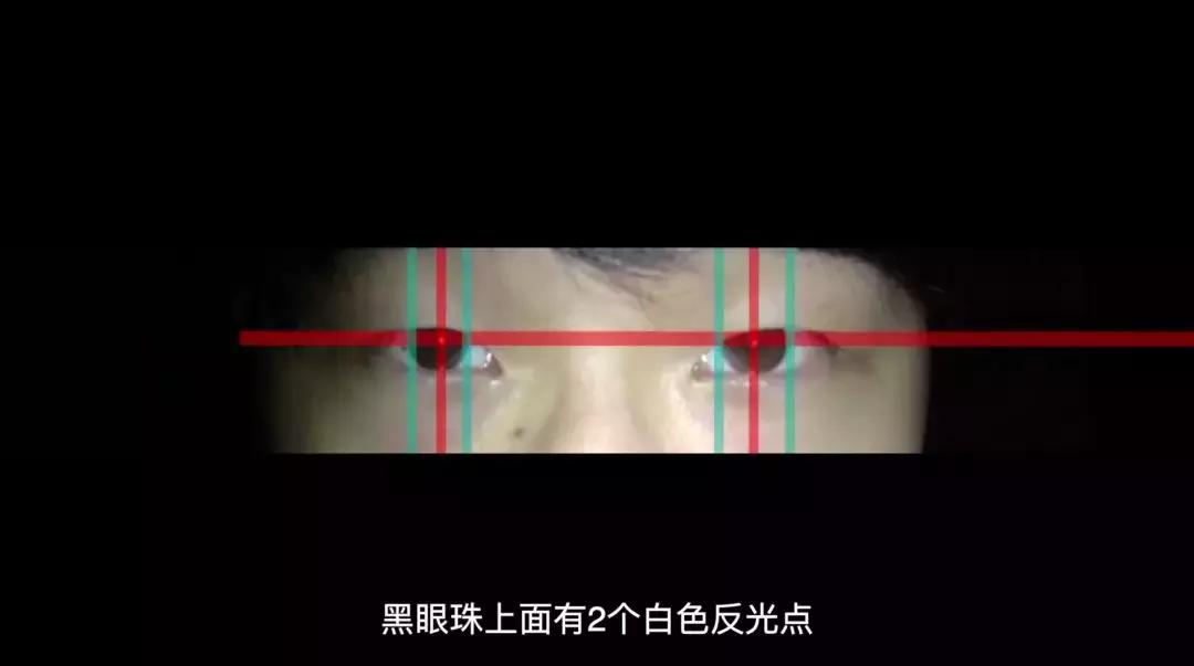 3秒辨别孩子是不是斗鸡眼,怎么判断小孩斗鸡眼