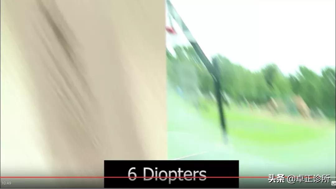 小孩眼睛近视散光怎么改善,眼睛散光近视要怎么改善