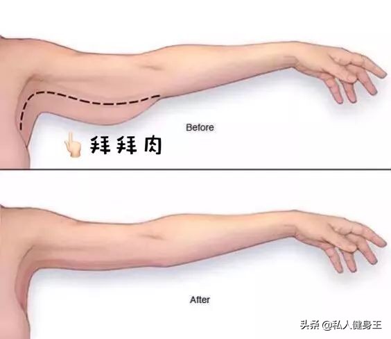 七分袖瘦手臂最快的方法,穿吊带瘦手臂的方法