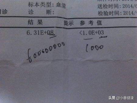 结合病毒基因(DNA),乙肝145阳性者,重视早期肝硬化预防