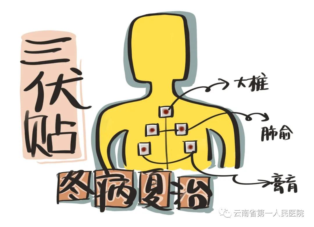 三伏贴敷冬病夏治正当时,三伏贴早上贴还是晚上贴好