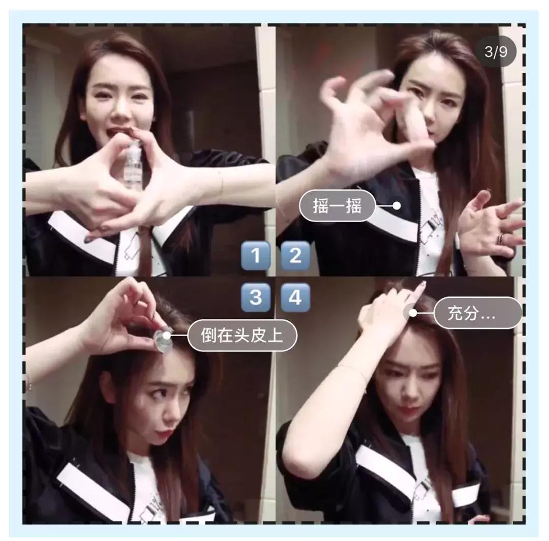 赵丽颖秃头照,赵丽颖秃顶原因