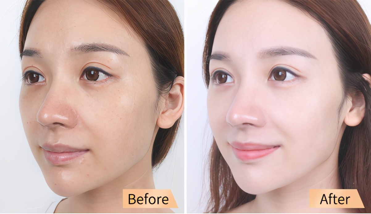 吉米抗皱祛斑霜,吉米时光焕颜祛斑组合套装