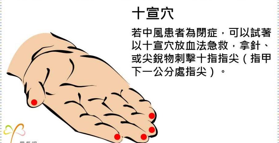 潘粤明父亲中风,潘粤明父亲突发脑溢血