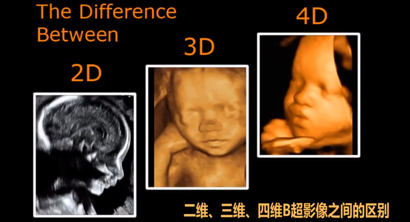 孕中期产检都有哪些项目,孕中期产检项目及最佳检查时间