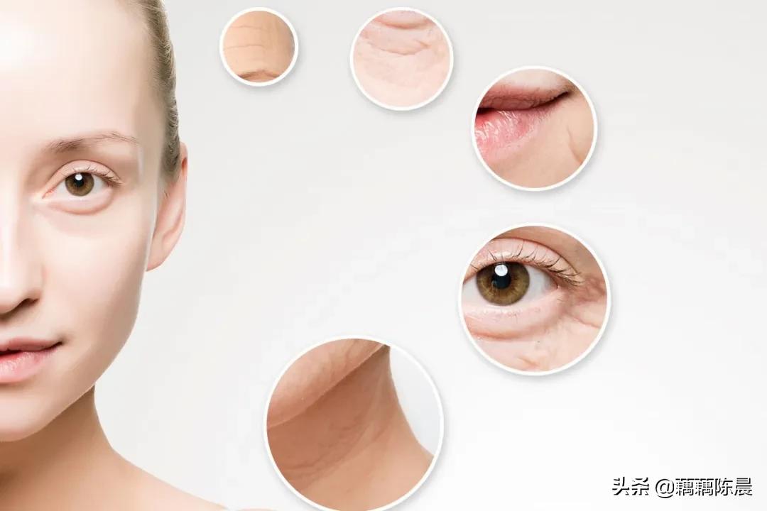 法令纹显老10岁试试这个新办法,法令纹最自然的改善方法是什么