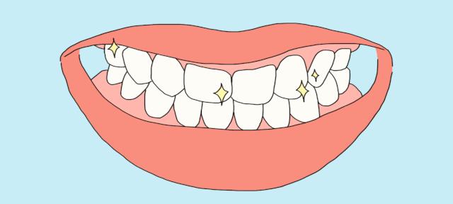 种植牙2500一颗和4500一颗的区别,8000的种植牙和10000种植牙区别