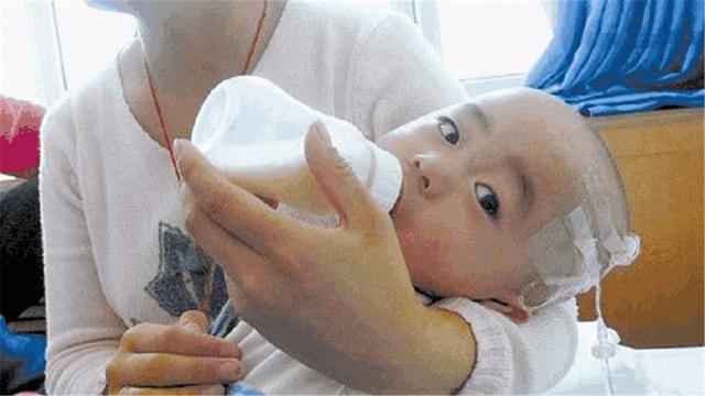孩子喝到问题奶粉,喝奶粉宝宝脑袋变大事件