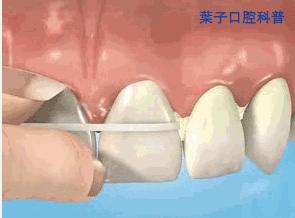 葉子口腔科普,口腔健康自查