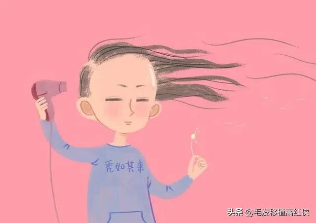 一级到二级脱发严重吗,脱发7级程度