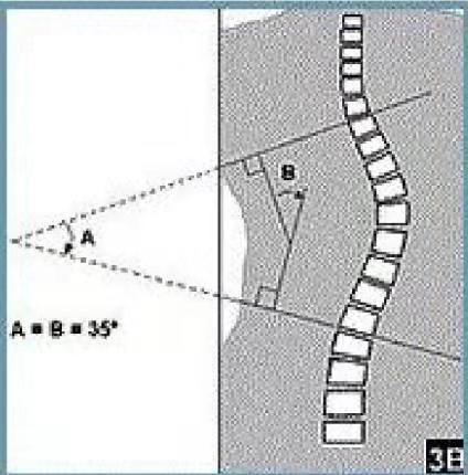 怎么矫正高低肩长短腿,脊柱侧弯高低肩瑜伽体式纠正