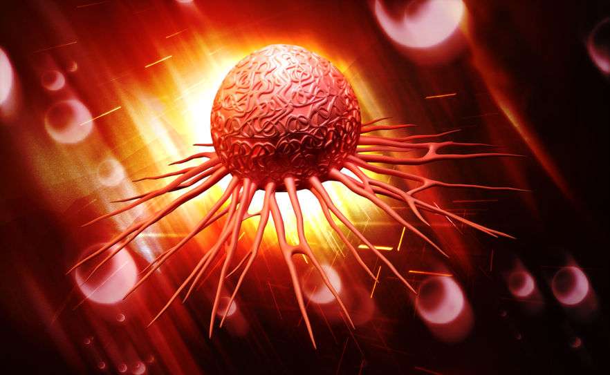 癌症复发后转移,还能救吗?医生直言:4个方法或能救上一命