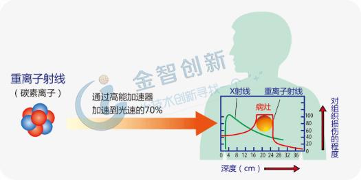 放射离子注入能消除肿瘤吗,放射治疗能根除肿瘤吗