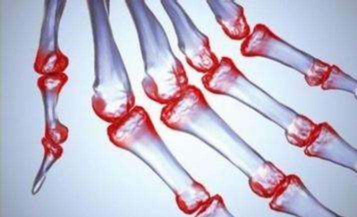 一变天就有反应,难道身体真有“预测天气”的功能