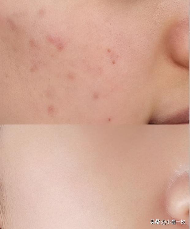 做医美真的可以变美,做什么医美可以让皮肤透亮