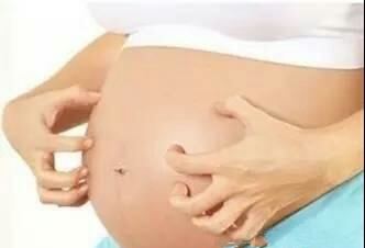 孕期肚皮痒抹什么可以缓解,孕期肚子痒有什么办法可以解决