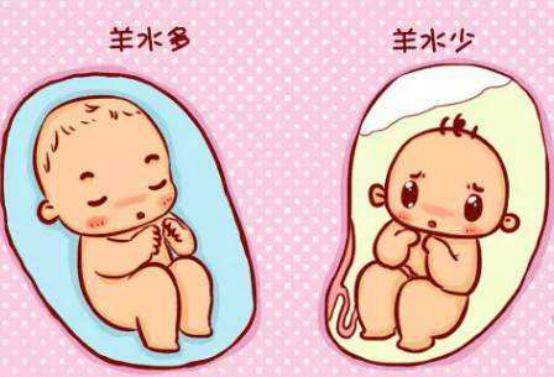孕晚期羊水过多该有什么措施,孕37周羊水不足可以提前打催产针