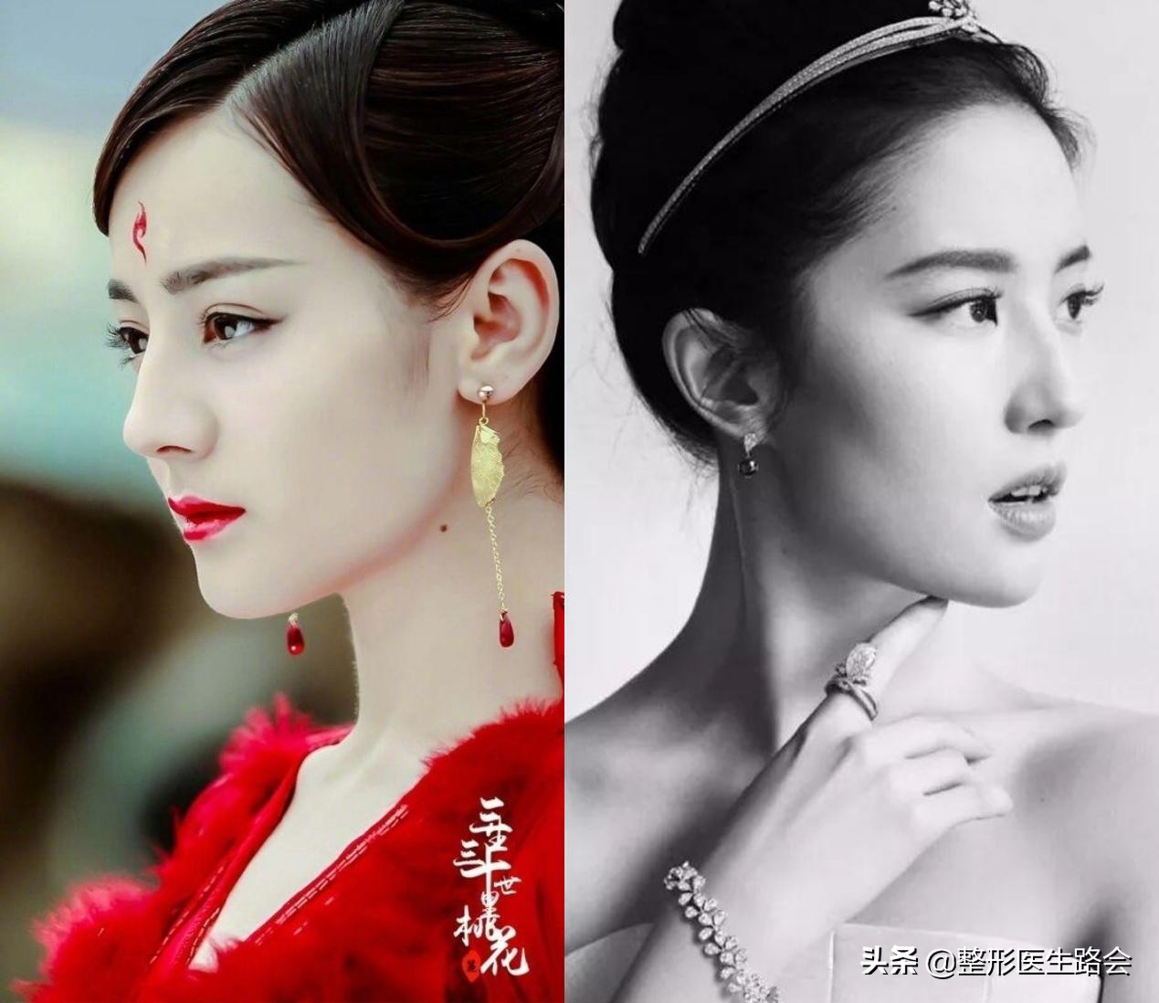 直鼻微翘怎么整,直鼻微翘怎么做出来自然又好看