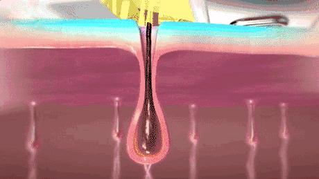 j-style脱毛仪怎么用,j-style脱毛仪怎样